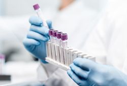 同伴诊断个性化医疗的关键