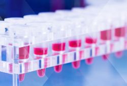 液体活检是什么?精密医学未来的工具。